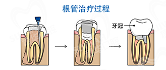 圖片8.png